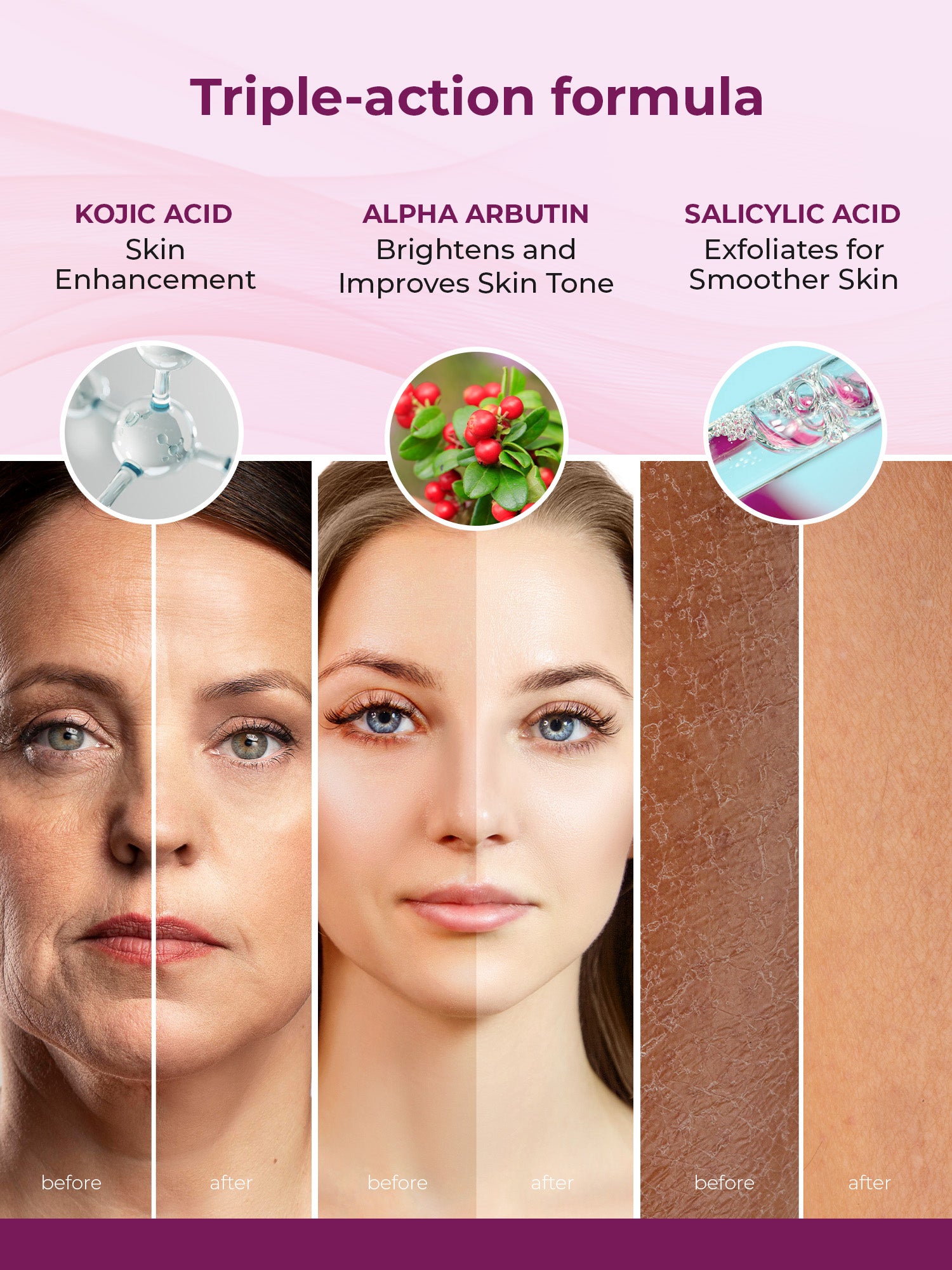 Kozicare Kojic Acid Soap - Dark Spot Remover