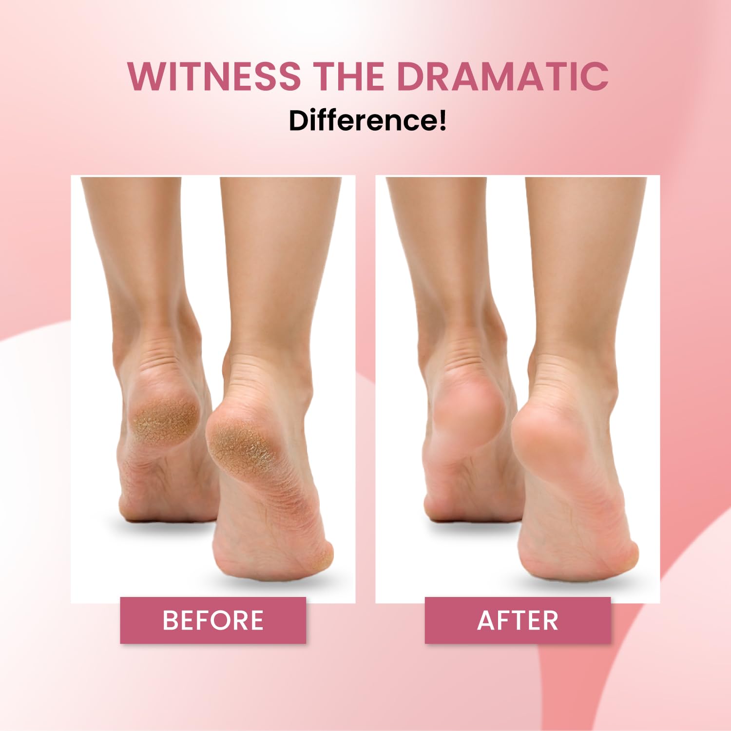Urban Yog hair removal spray - for women's legs