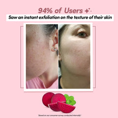 Prolixr AHA BHA & Beetroot Exfoliating Face Mask | Brightens Skin | Pore Cleansing | Men & Women - 60g