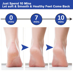 Dr Foot 40% Urea Gel Moisturizes Callus Cracked Rough Dry Dead Skin- 100gm & Dr Foot Foot File Callus Remover | For Dead skin, Calluses, Cracked Heels & Hard Skin Remover - With Free Brush