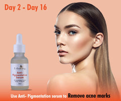 Urban Yog Face Care Combo Kit- Anti-Pigmentation Serum (30 ml) and Acne Pimple Patch (72 Dots) for and Clear Skin with 100% Hydrocolloid 10% Niacinamide | For acne and dark spots | For all skin types