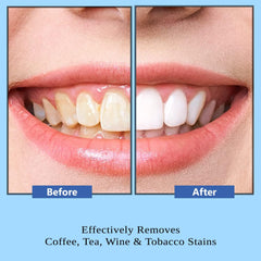 Oralvit Teeth Whitening Combo| Baking Soda Toothpaste & Sodium Bicarbonate Teeth Whitening Powder (100 g, 50g)