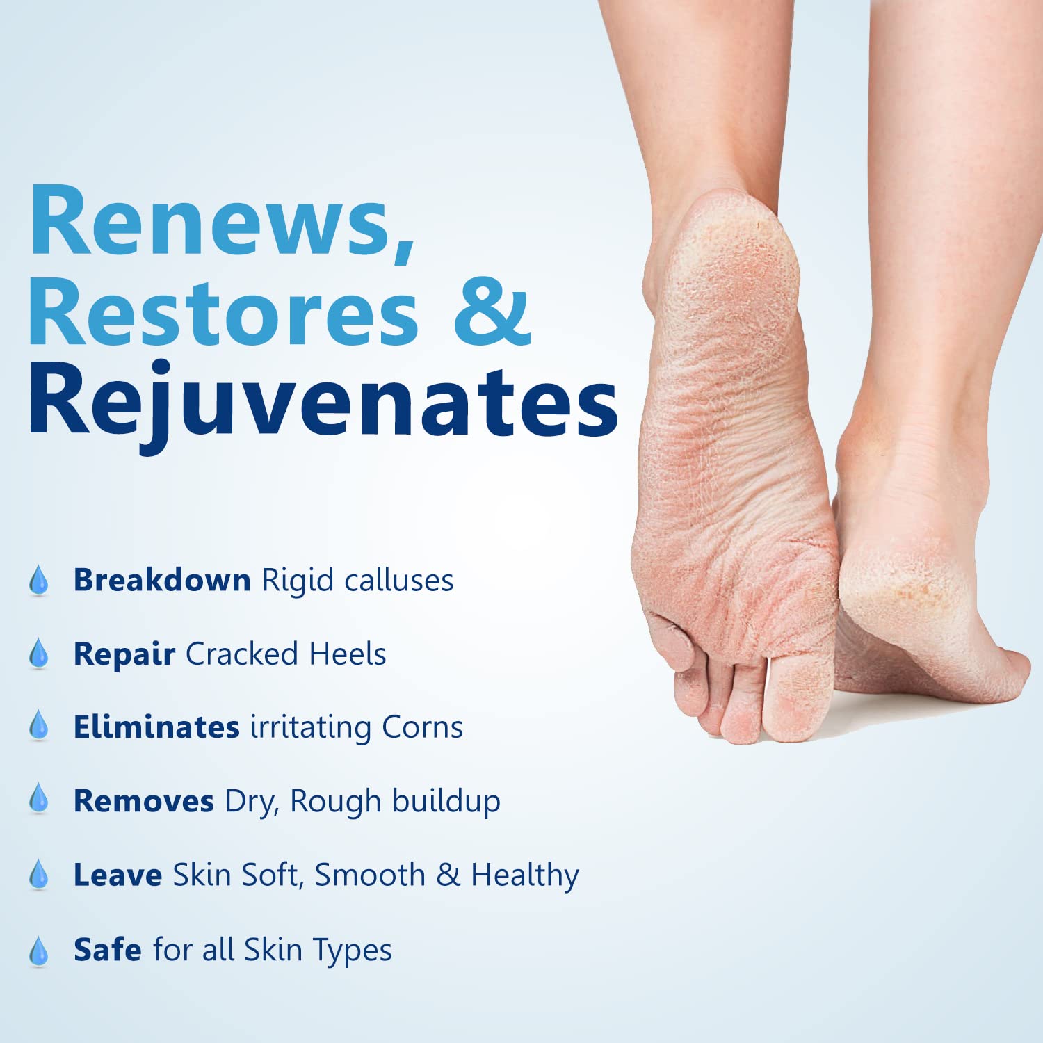 Foot Creams, Files & Hard Skin Remover - Scholl UK