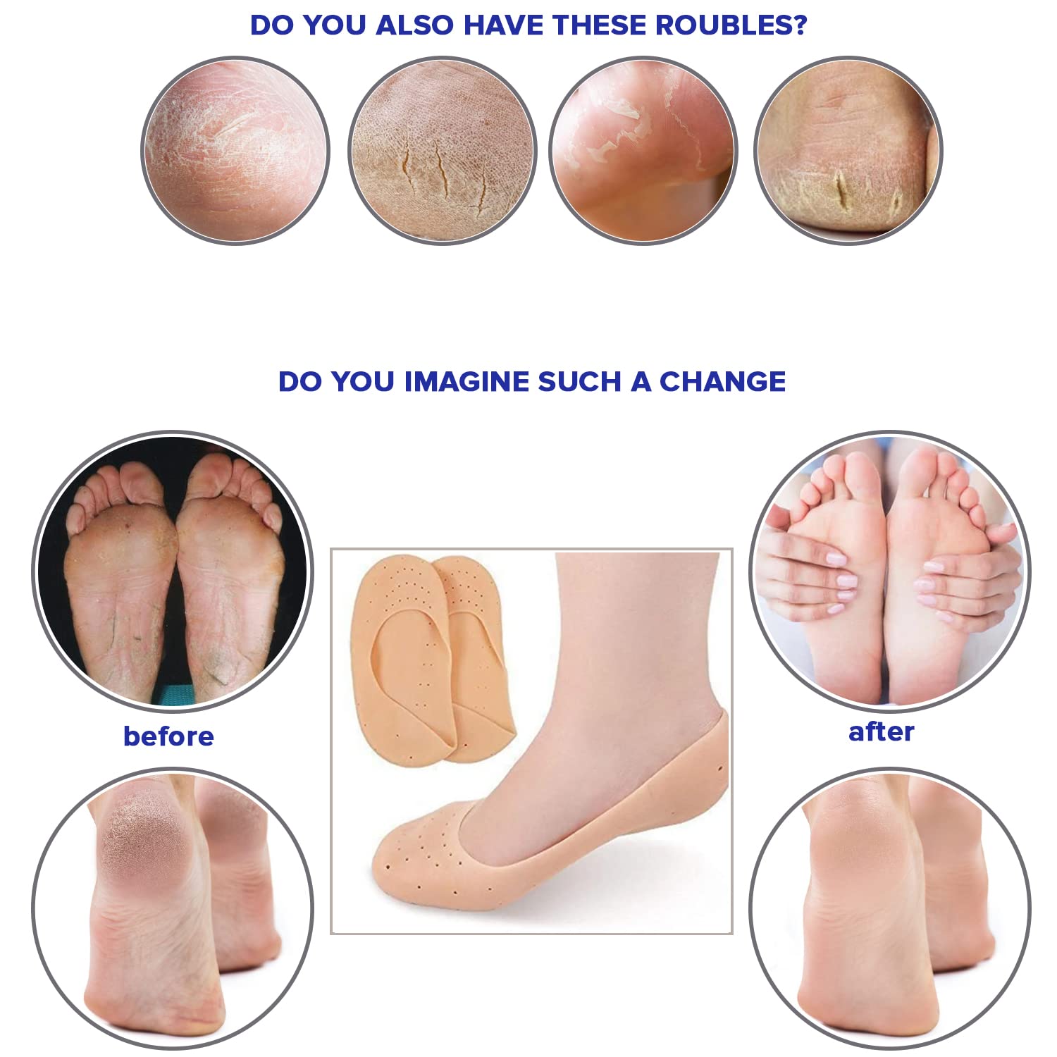 Matra Foot Cream for Cracked Heels and Dry Feet with Aloe Vera & Tea Tree  Oil - MyMatra.com