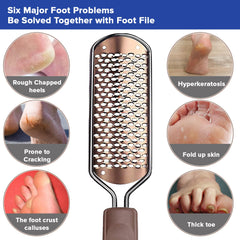 Dr Foot Callus Remover Gel Helps to Remove Calluses and Corns - 100ml & Dr Foot Glass File Callus Remover | for Feet, Dead Skin, Callus Remover - Rose