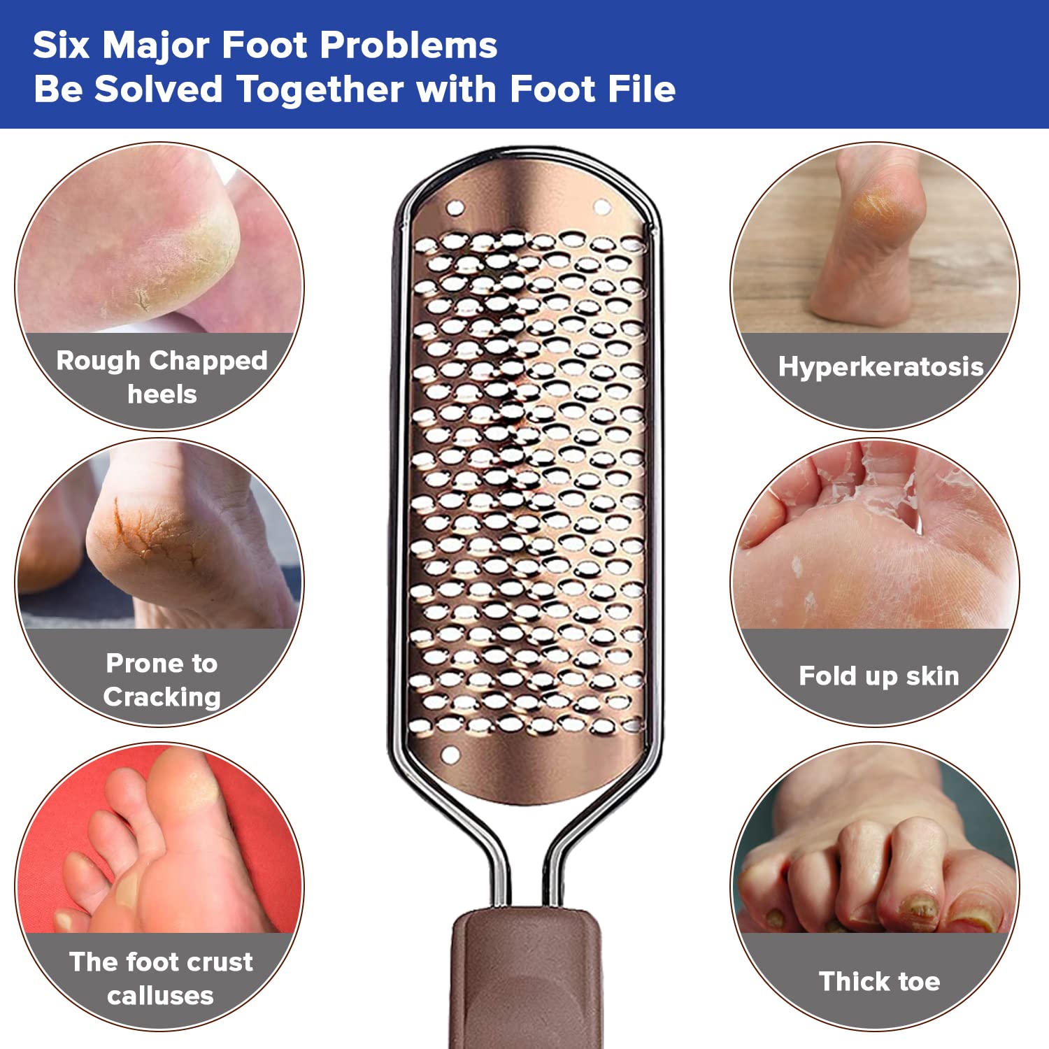 Moisturizing Socks for Women & Men | Aloe Vera Cracked Heel Treatment | Foot  Callus Remover